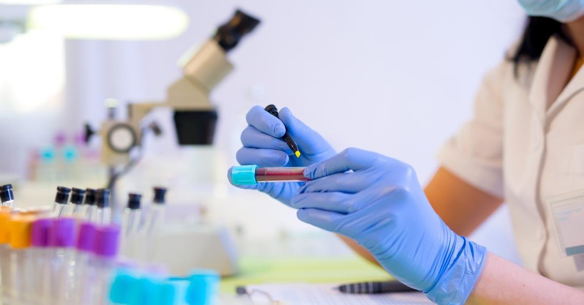 Catalonia memajukan pengawasan infeksi seksual menjadi 12 tahun